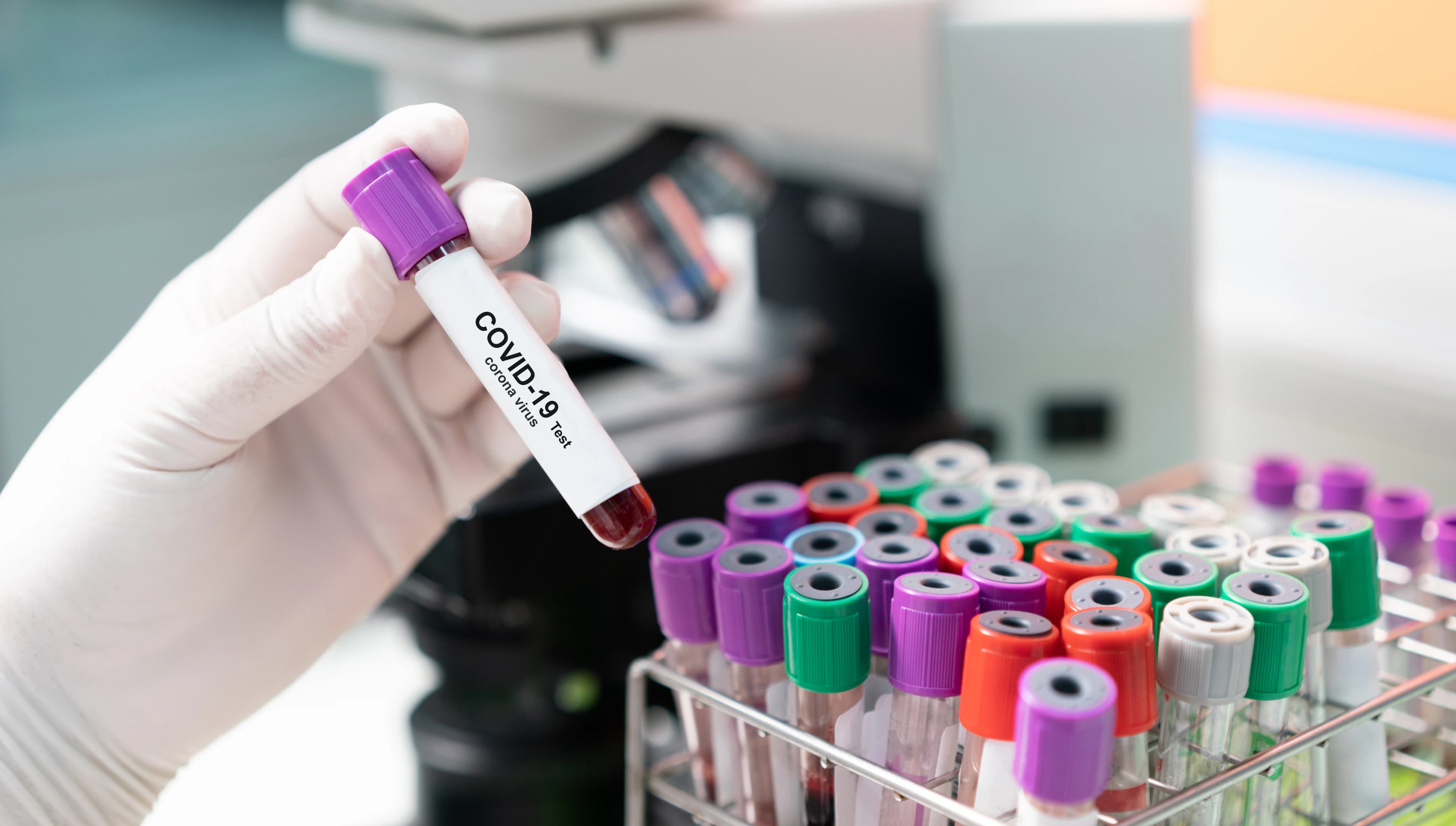 Novo exame detecta presença de anticorpos neutralizantes contra o coronavírus